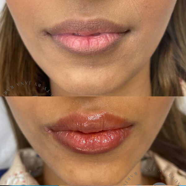 Lip Blushing Lip Blushing